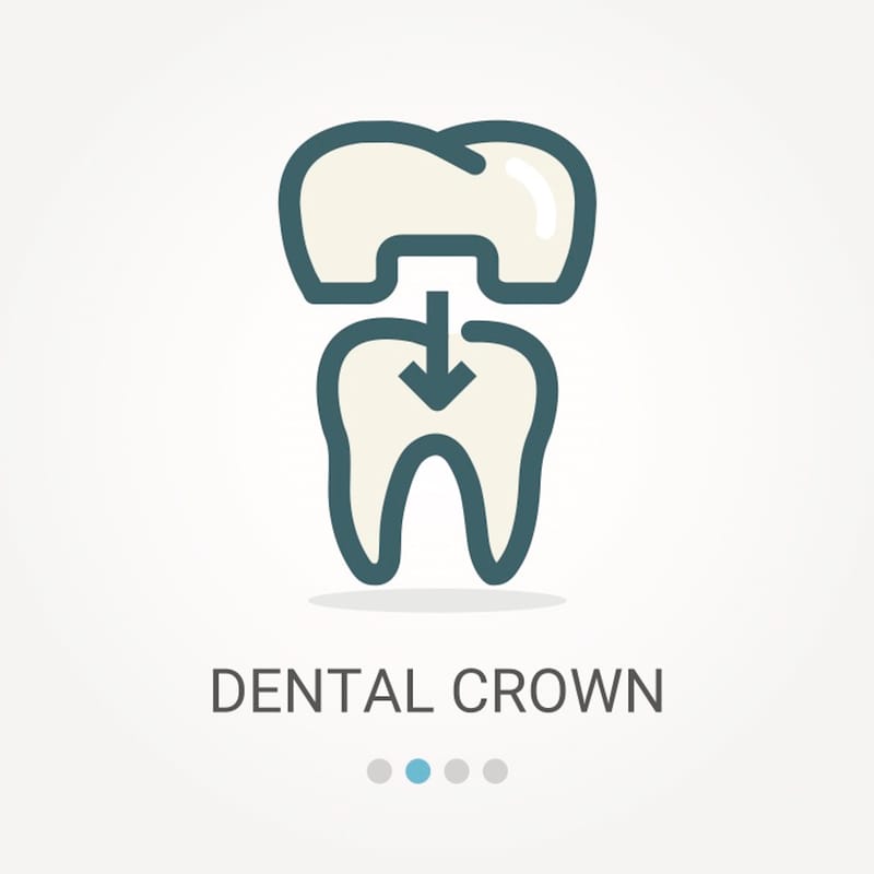 Dental crown cap, cemented and temporary examples