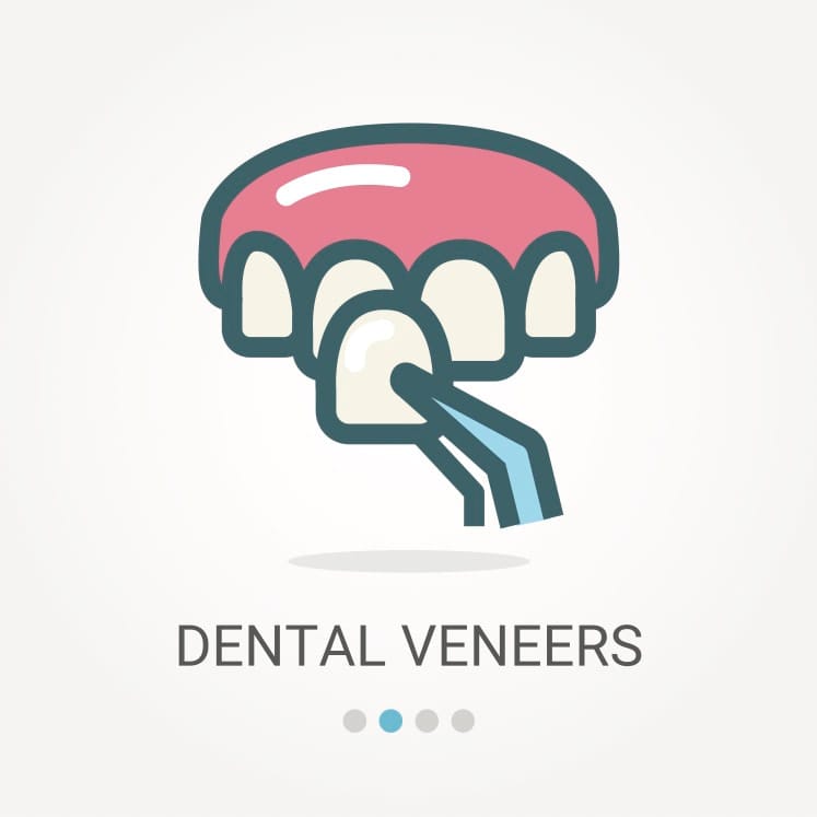 Dental veneers at TruCare Dentistry