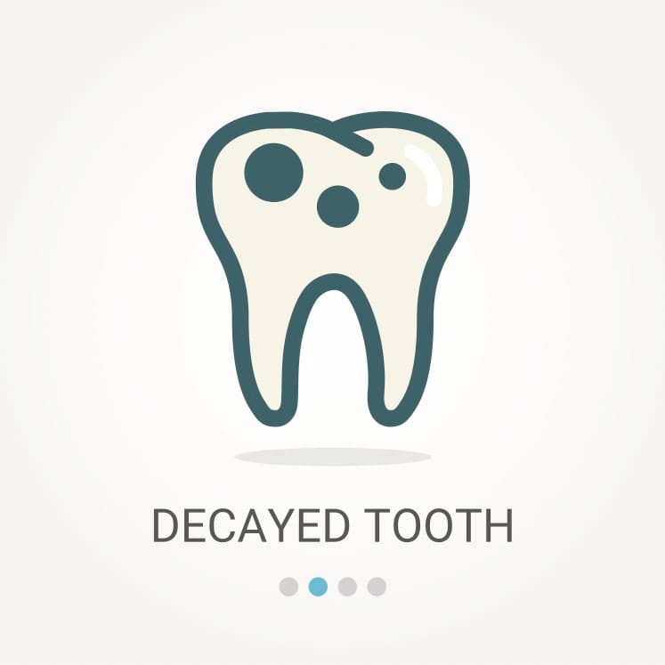 Tooth decay relief and cavity repair at TruCare Dentistry